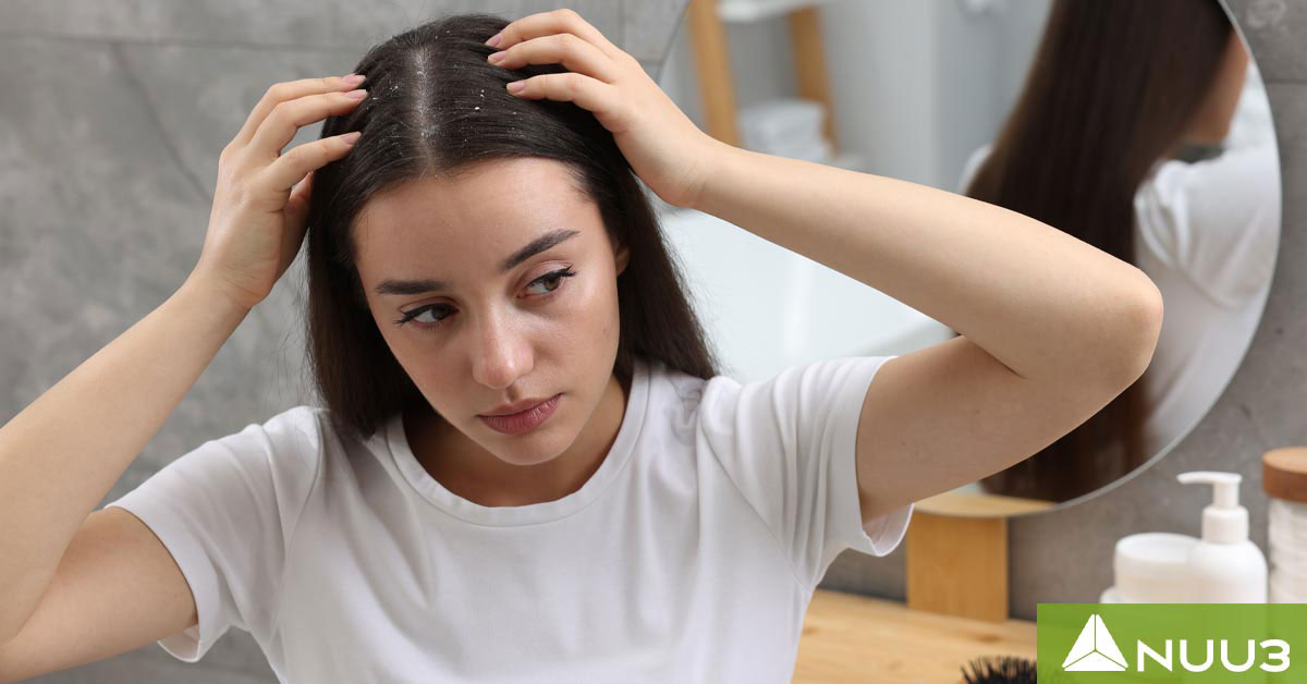 How to Manage Scalp Eczema and Relieve Itchy, Flaky Skin